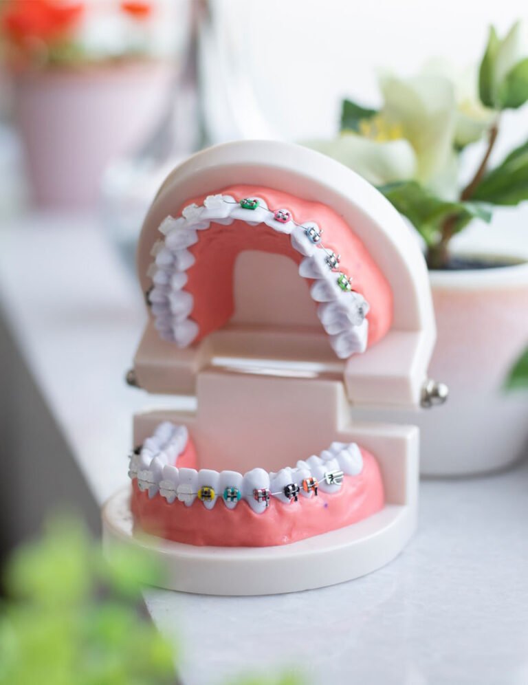 orthodontist Pijnacker